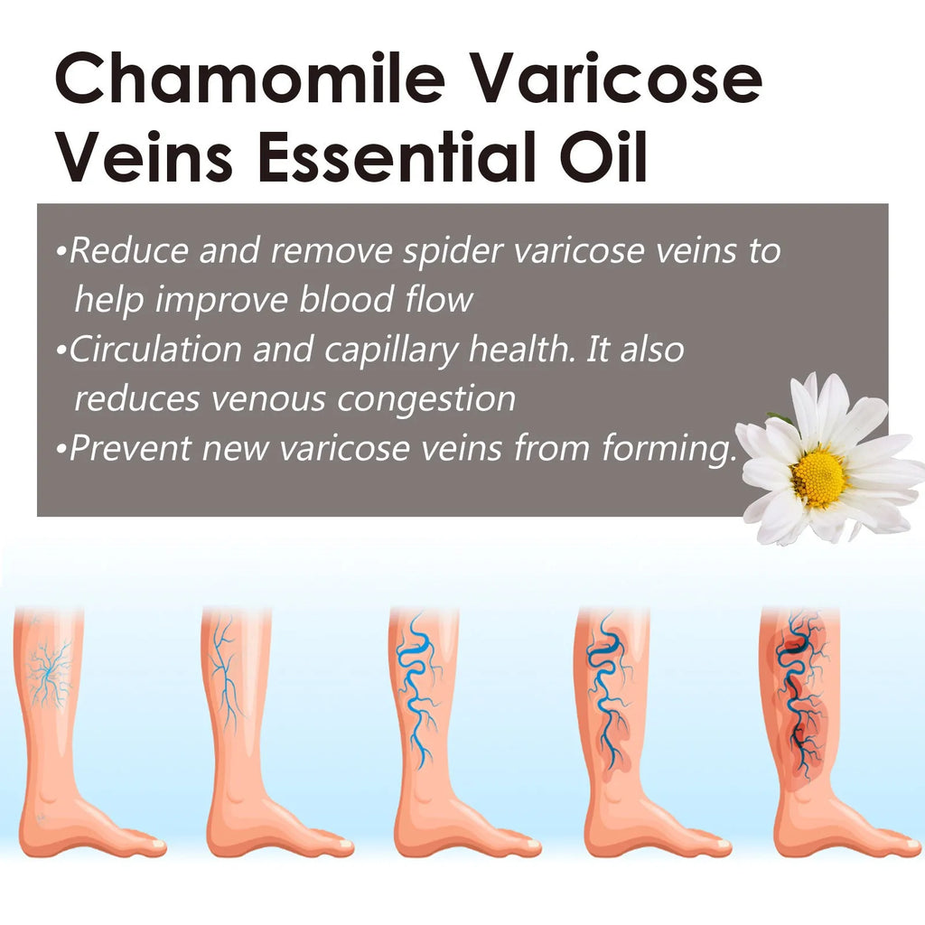10ml bottle of chamomile essential oil for leg and skin care massage