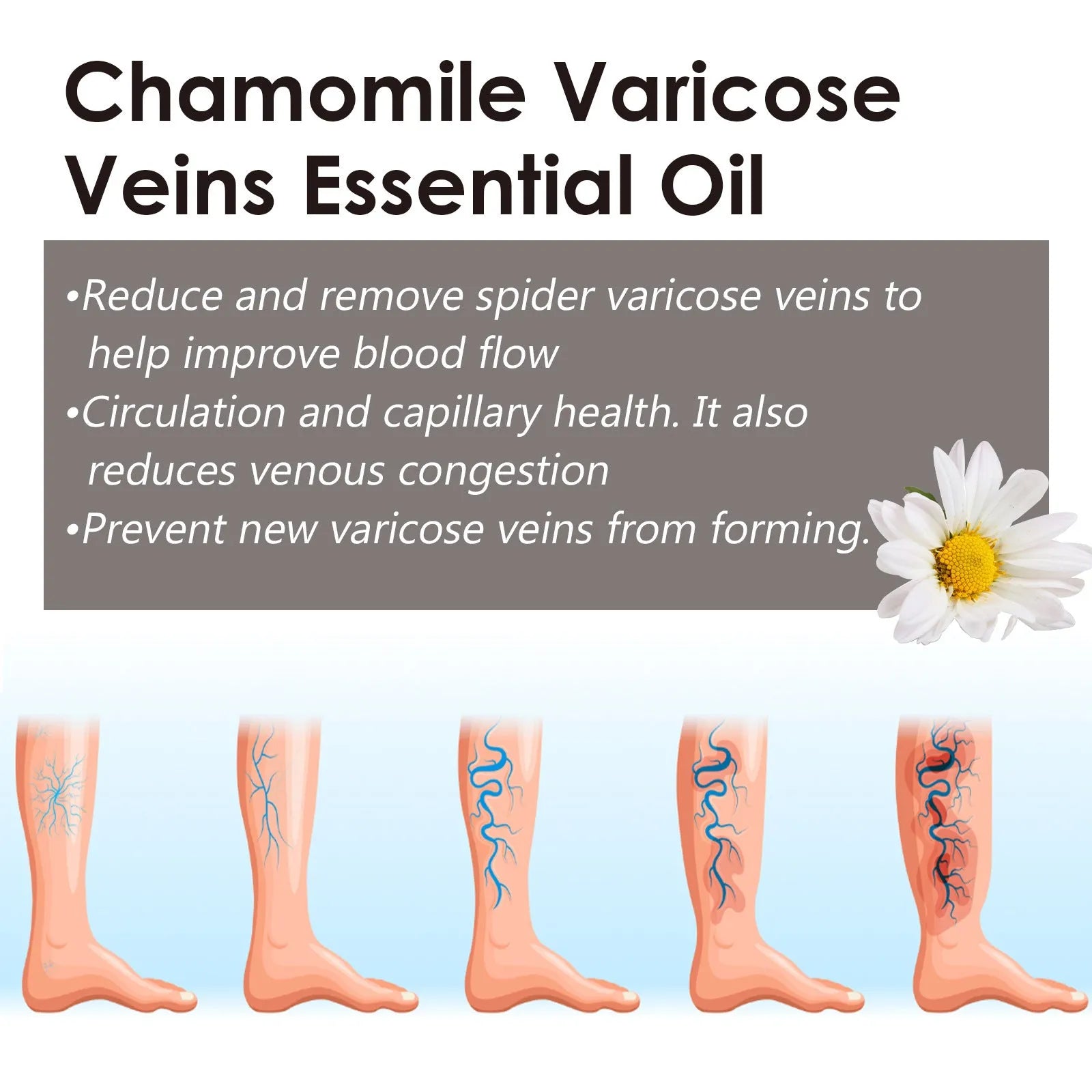 10ml bottle of chamomile essential oil for leg and skin care massage