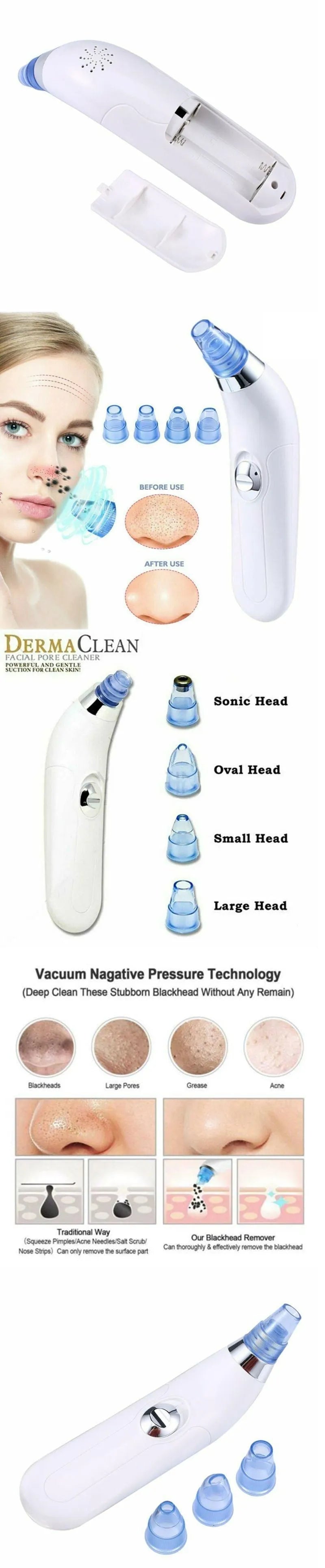 Electric pore blackhead cleaner in pink and white colours with ultrasonic vibration working method for facial skincare