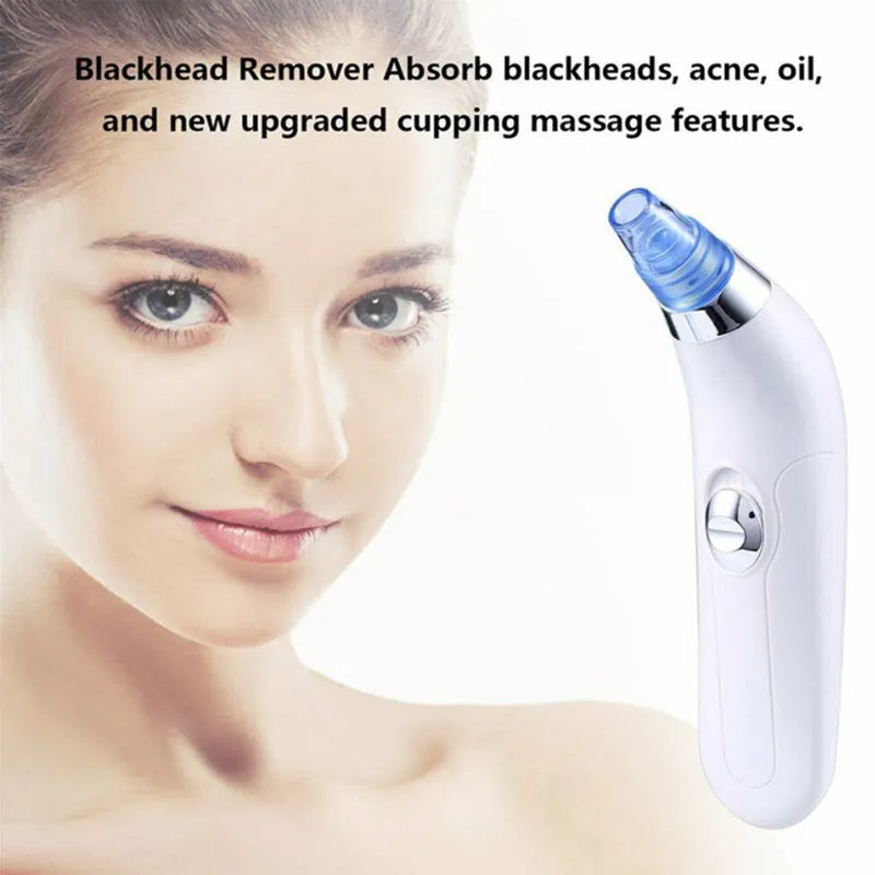 Electric pore blackhead cleaner in pink and white colours with ultrasonic vibration working method for facial skincare