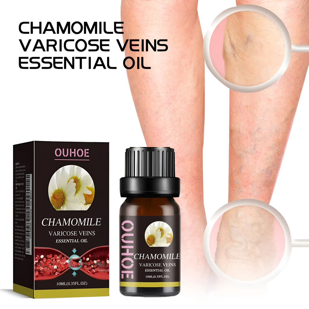 10ml bottle of chamomile essential oil for leg and skin care massage