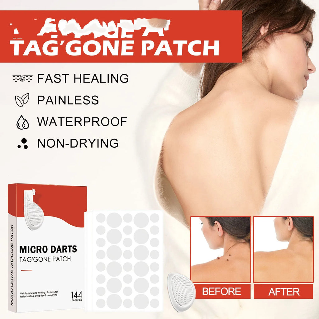 Acne patch box with 144 patches of tea tree oil and calendula extract