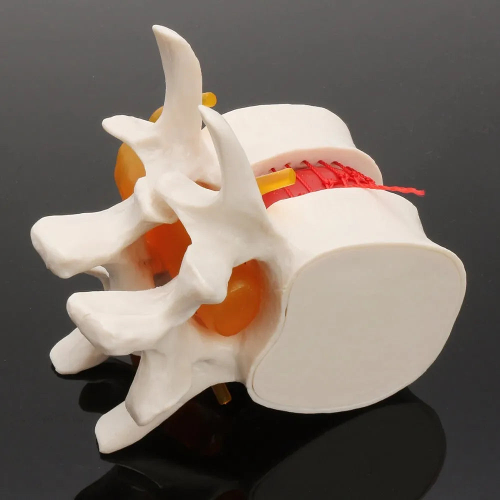 White PVC lumbar intervertebral disc herniation demonstration model for medical anatomy education