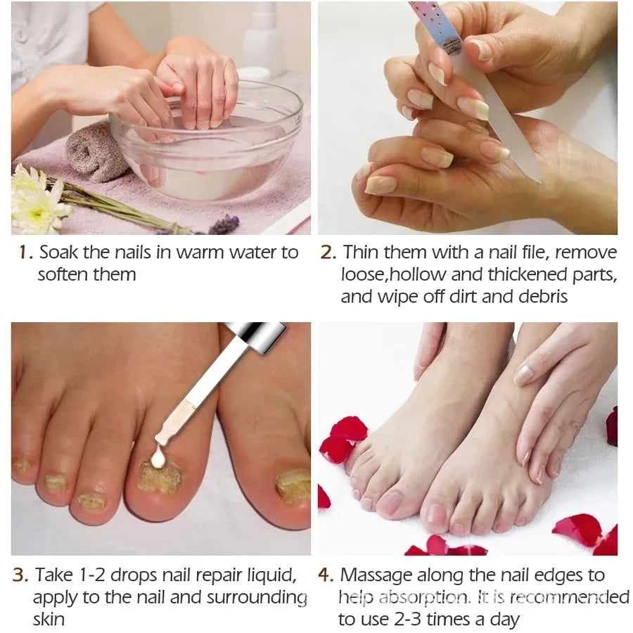 Jiagou 10ml Deck Liquid Antimicrobial Repair Dust bottle for toenail whitening and antibacterial treatment