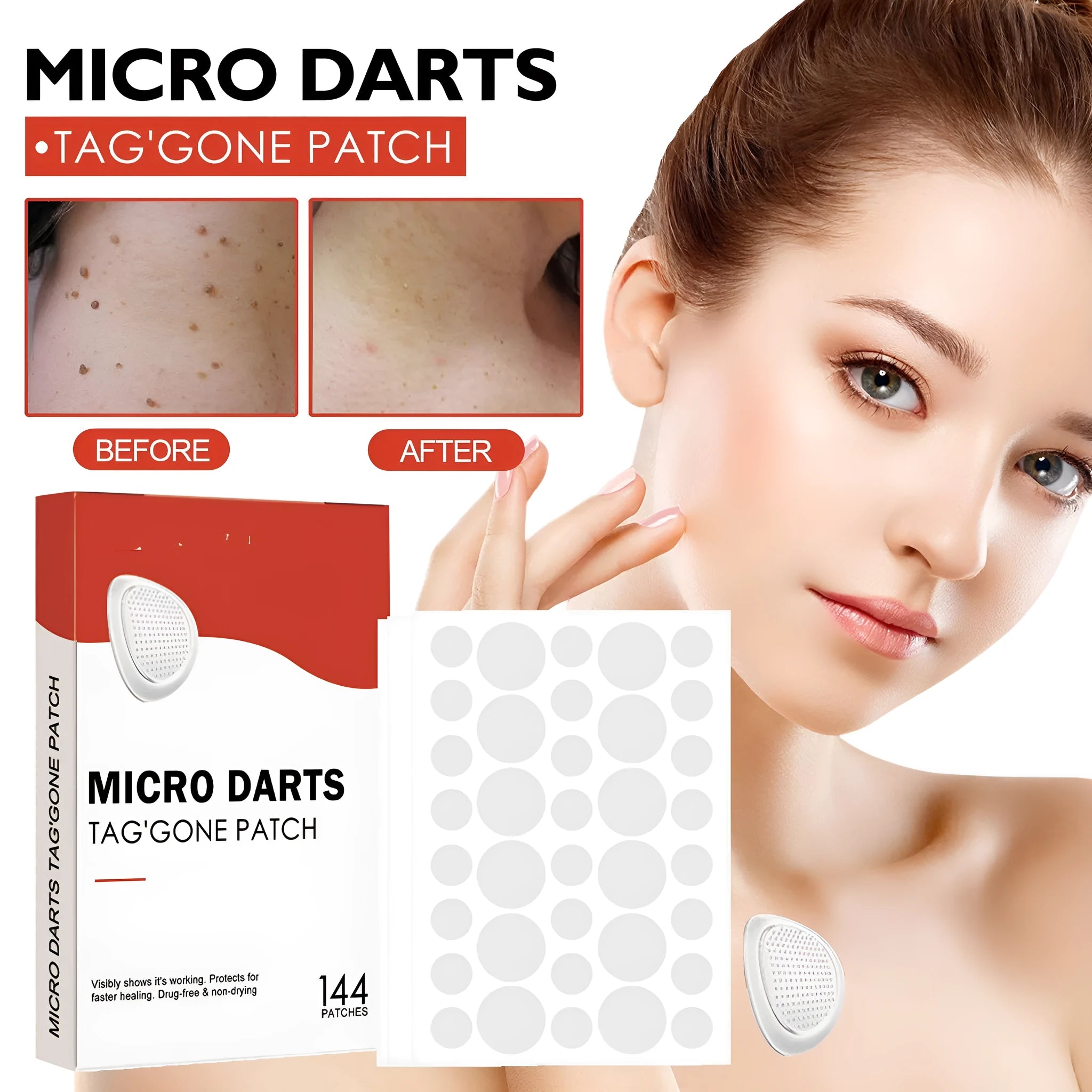 Acne patch box with 144 patches of tea tree oil and calendula extract