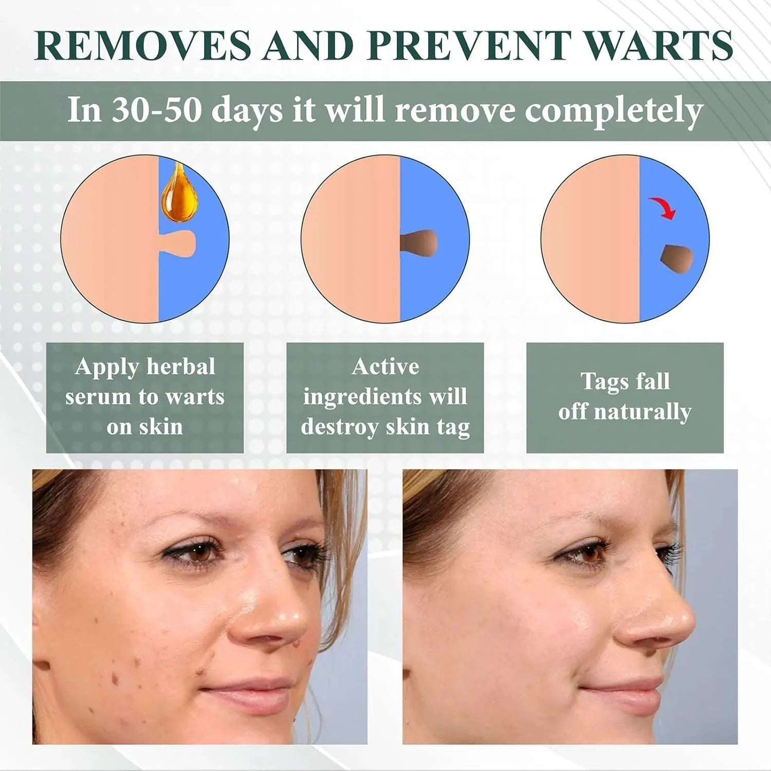 Natureerase Instant Mole Spot Removal Gel 45g container with hydrating formula