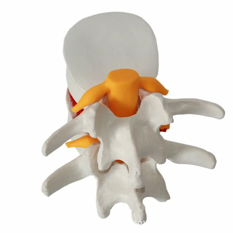 White PVC lumbar intervertebral disc herniation demonstration model for medical anatomy education