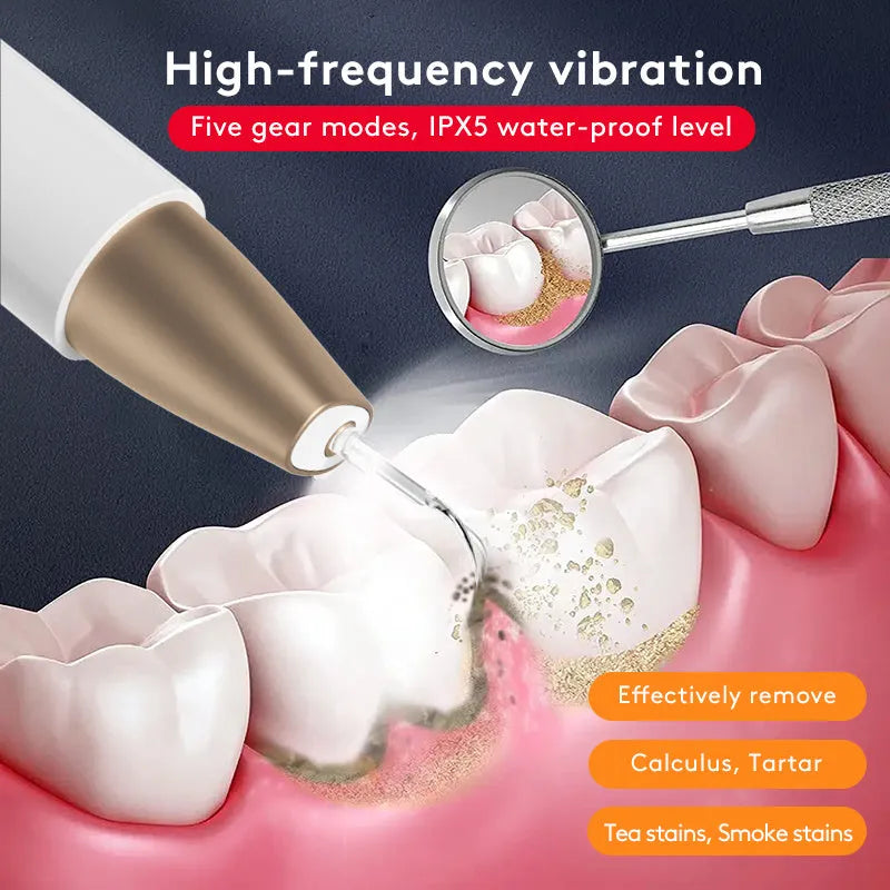 Gold-coloured ultrasonic teeth cleaning device for tartar and stain removal