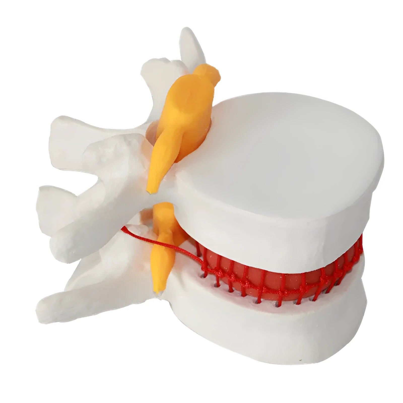 White PVC lumbar intervertebral disc herniation demonstration model for medical anatomy education