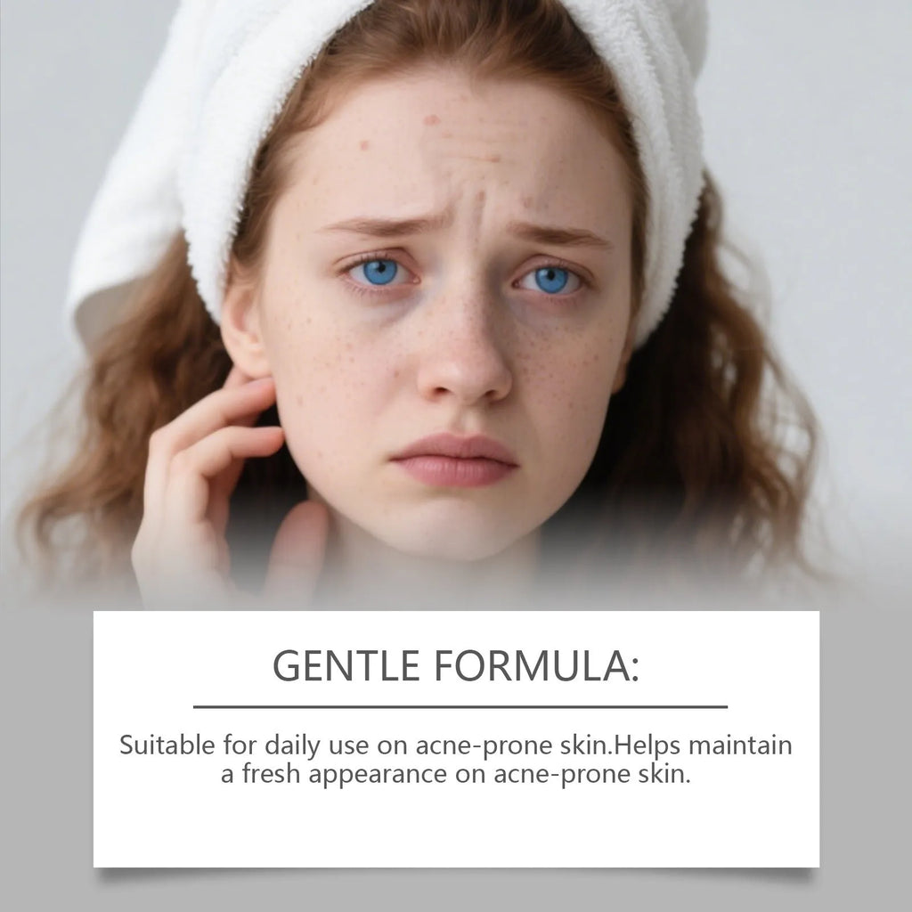 Pack of 80 gentle breathable acne patches for facial spot treatment