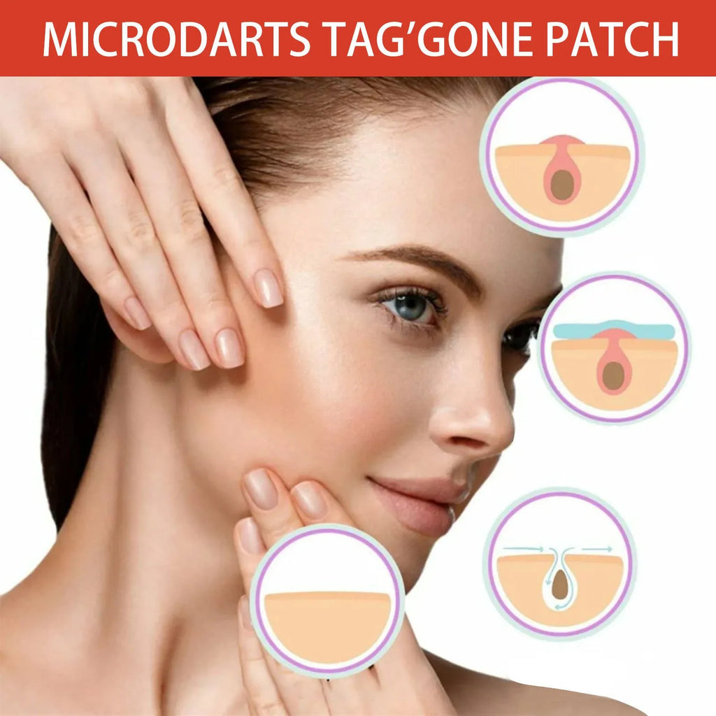 Acne patch box with 144 patches of tea tree oil and calendula extract