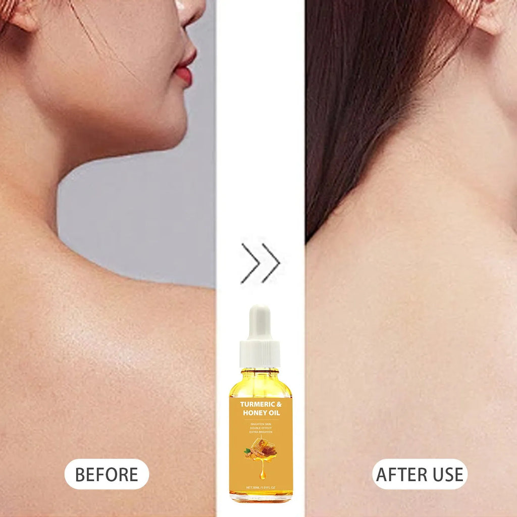 30ml glass bottle of Turmeric Honey Essential Oil with dropper on a neutral background.