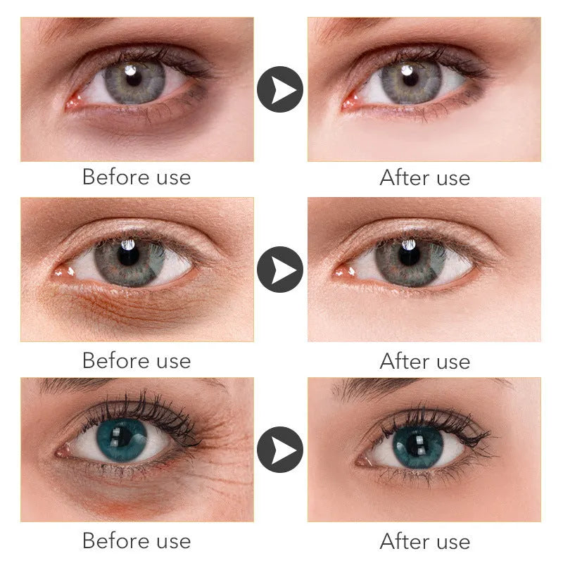 30ml beauty eye cream container with cream formulation for targeted eye area application