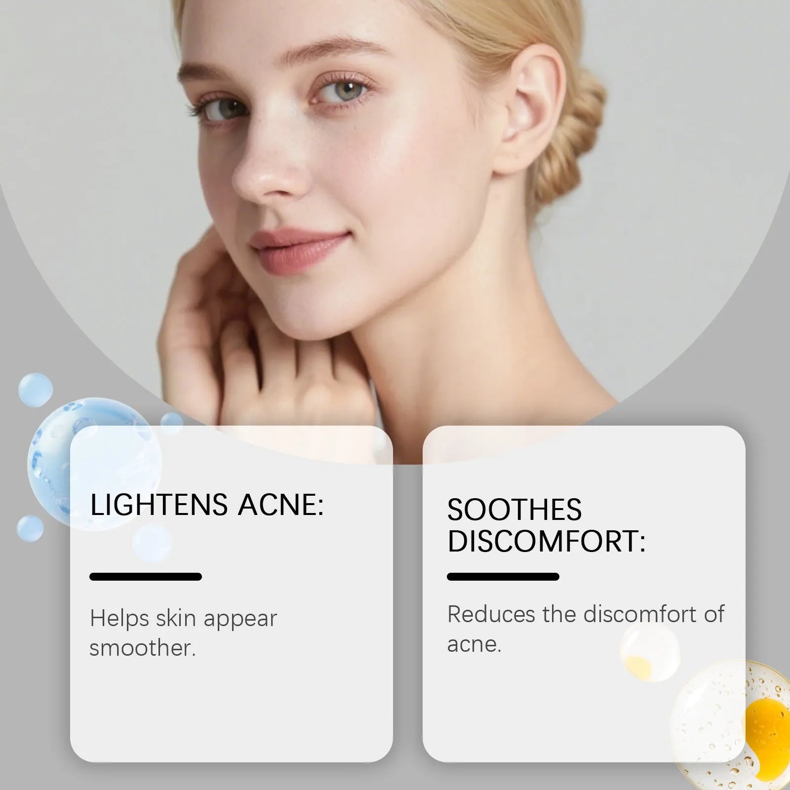 Pack of 80 gentle breathable acne patches for facial spot treatment