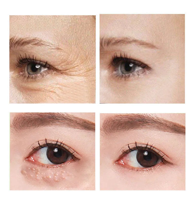 30ml beauty eye cream container with cream formulation for targeted eye area application