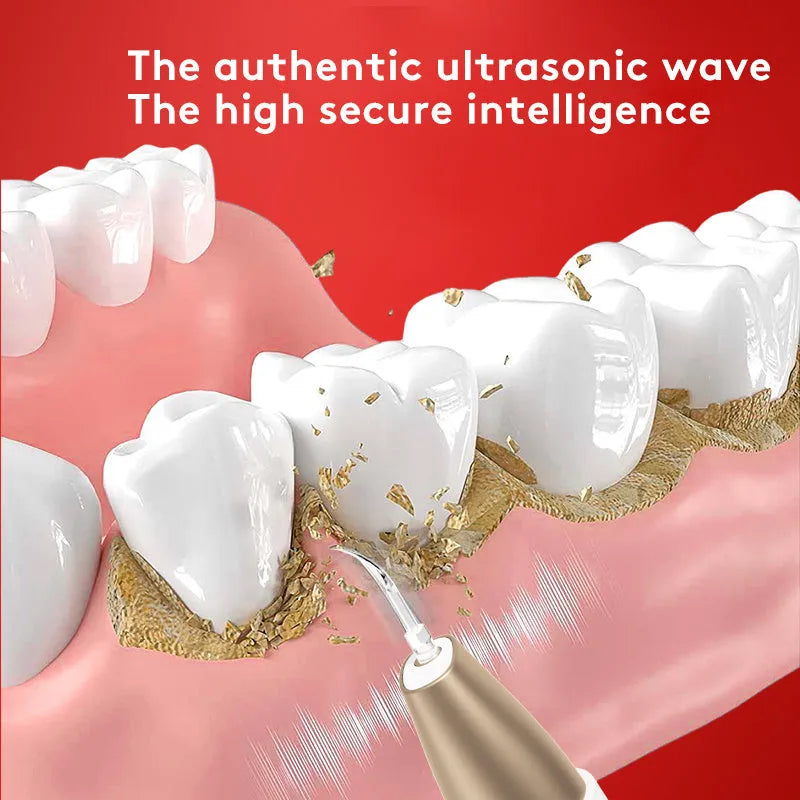 Gold-coloured ultrasonic teeth cleaning device for tartar and stain removal